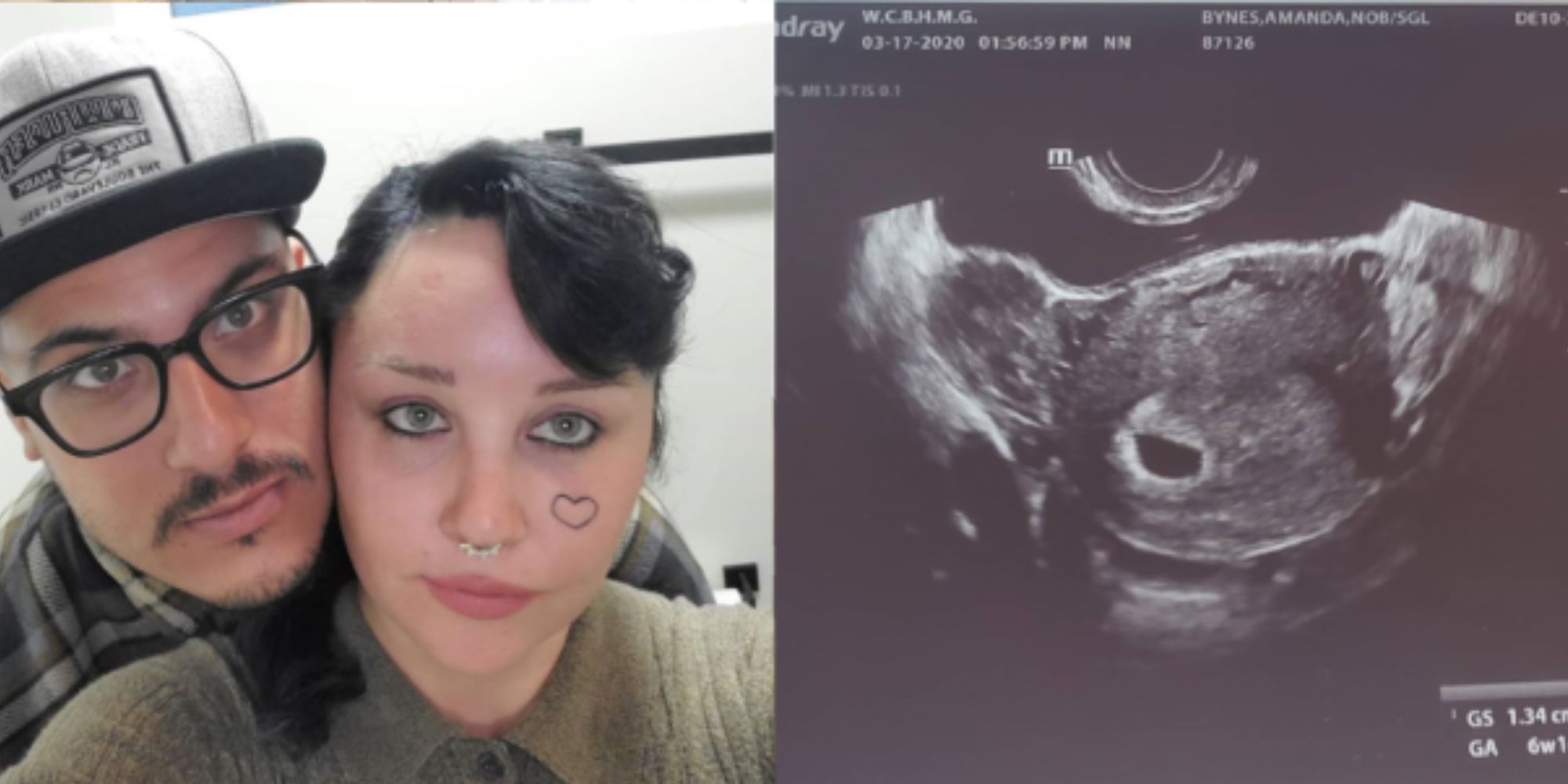 Amanda Bynes Reportedly Expecting Her First Child With ExFiance Paul