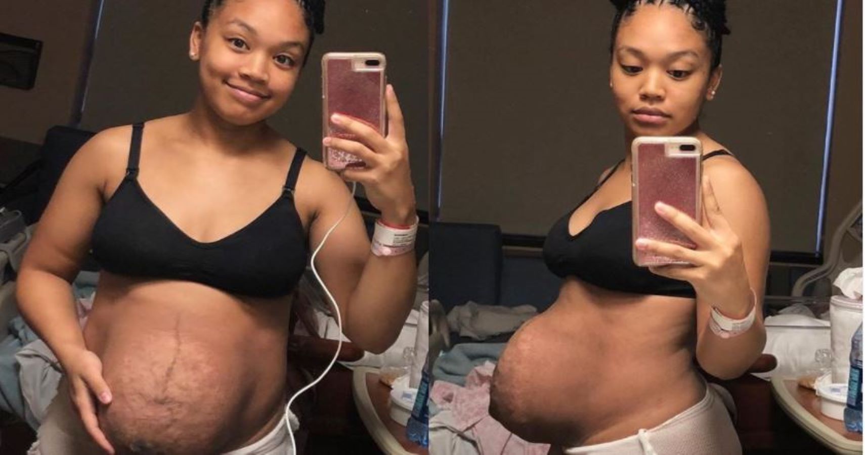 Mom Shares Monthly Postpartum Photos To Show How Women's Bodies Change