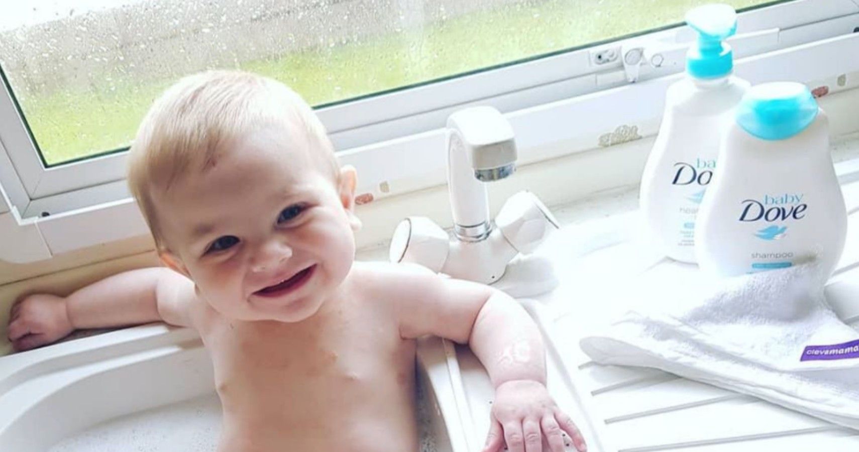 Baby Dove Pediatric Dermatologist On Causes & Treatment For Your Baby's