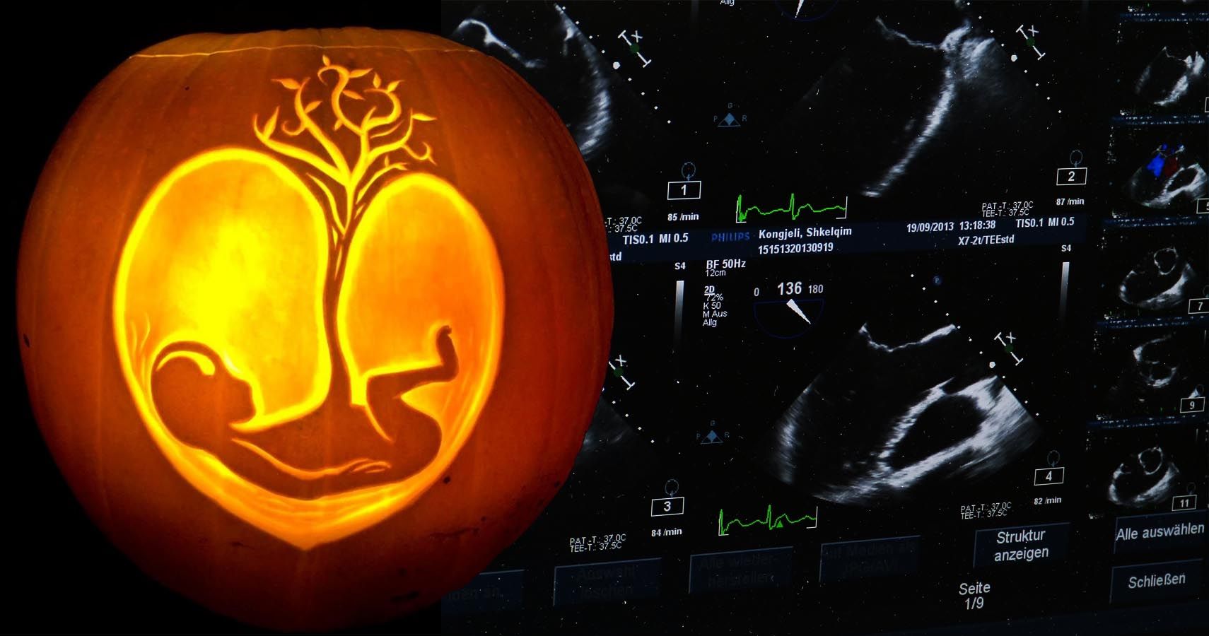 pumpkin ultrasound