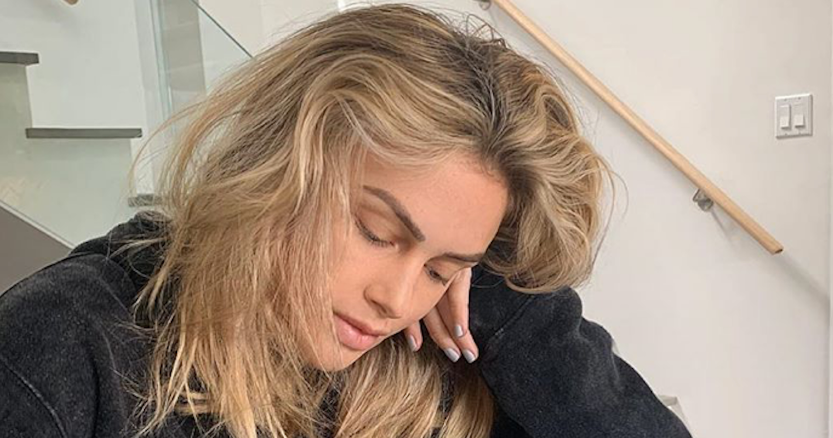 Lala Kent says pregnancy hormones are changing her skin