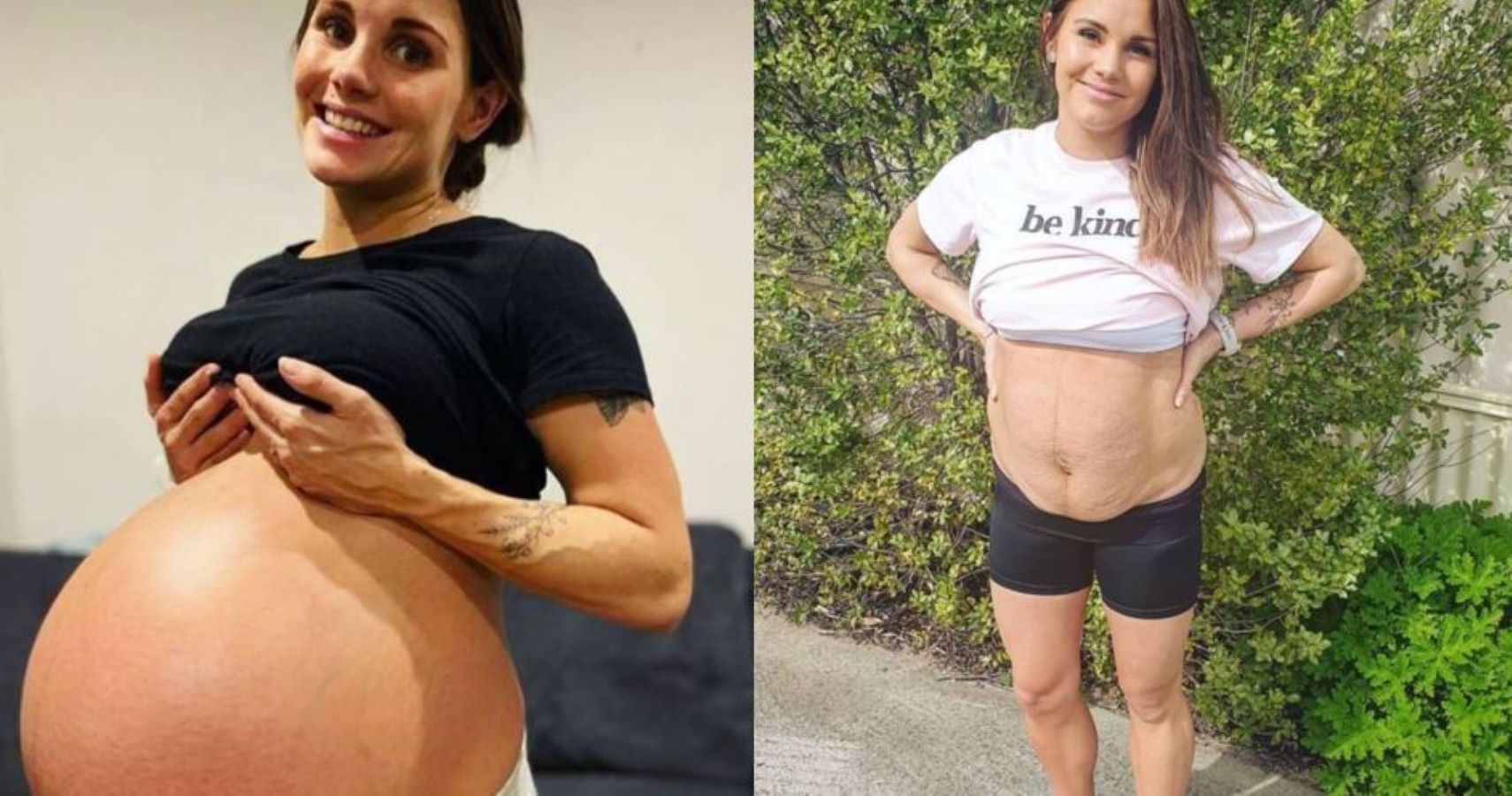 Natalie Mom birthed quadruplets talks postpartum body
