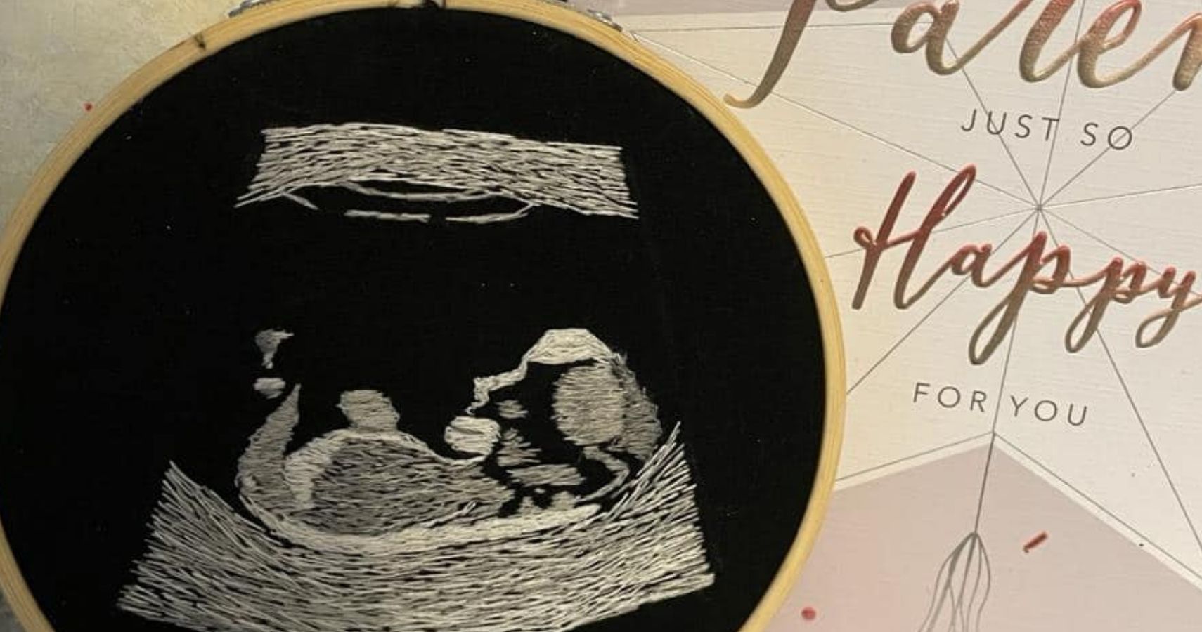 Nathan Edge embroidered ultra scan allows blind dad to see baby