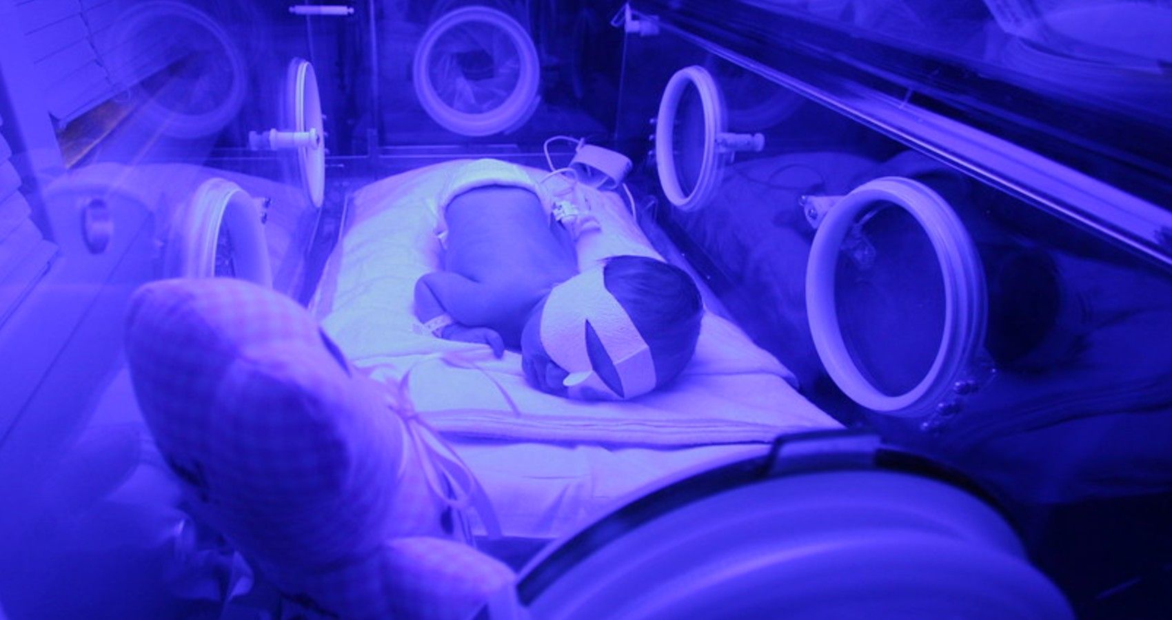 A newborn in the NICU for jaundice treatment