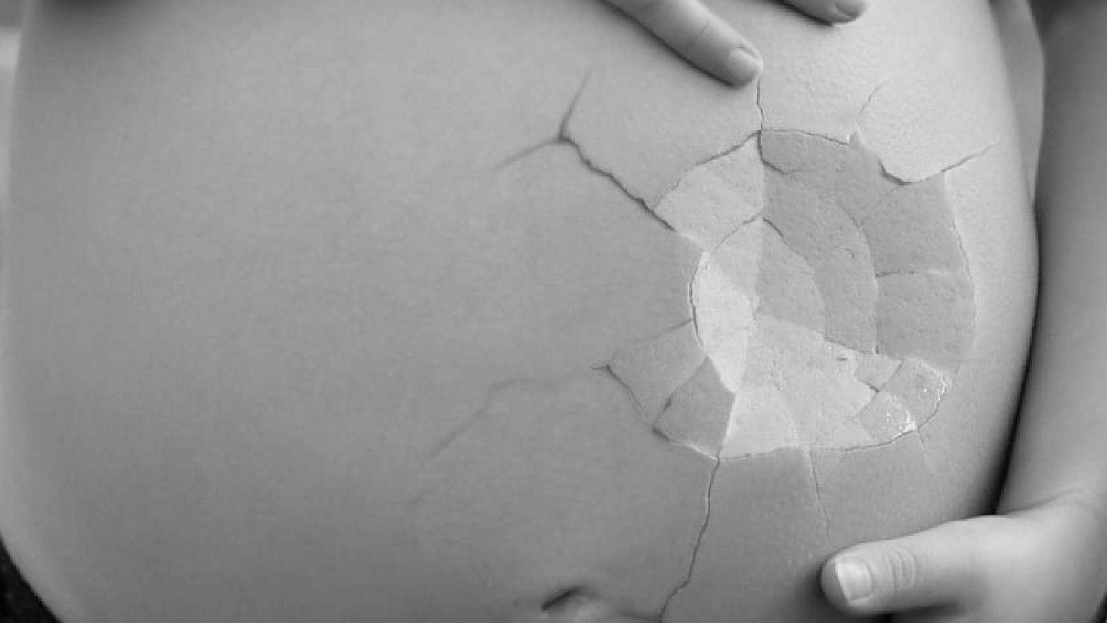 Jamie Otis Suffers Miscarriage Guilt