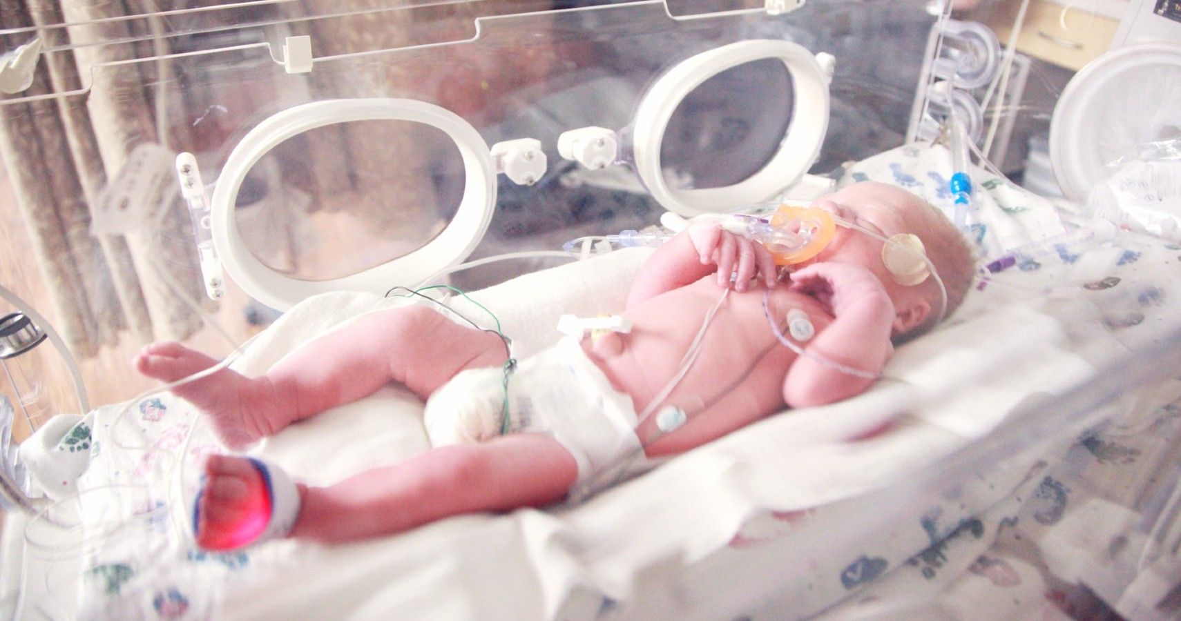 New Risk Assessment Tool May Help Lower Mortality Rate In Preemies
