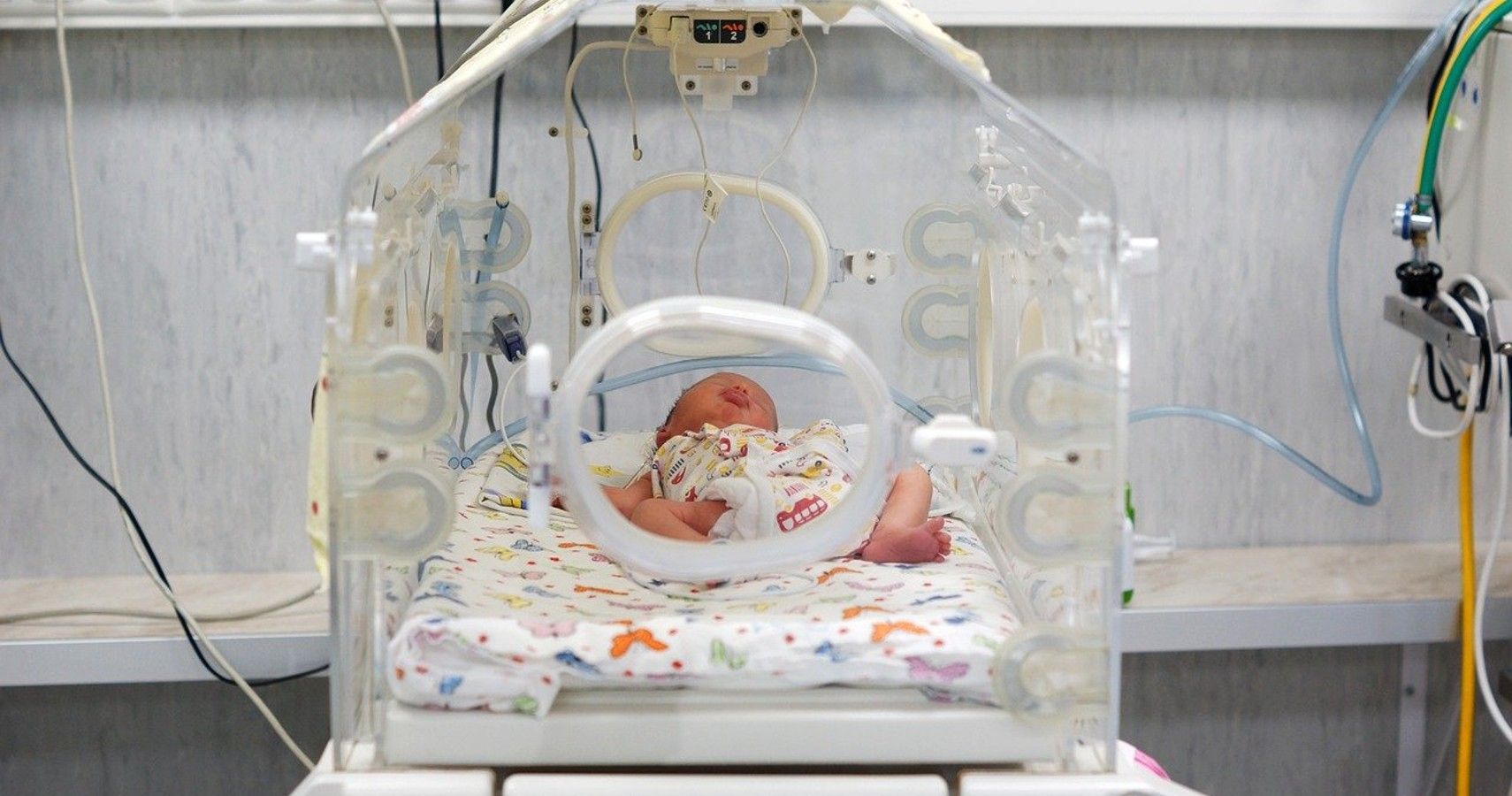 Female blood donors linked to better outcomes for transfused preterm infants (1)