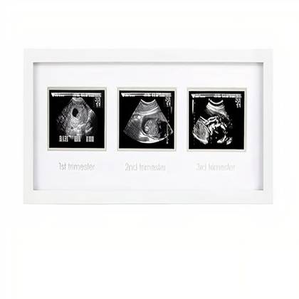Essential Products for Tracking Baby Milestones at Home